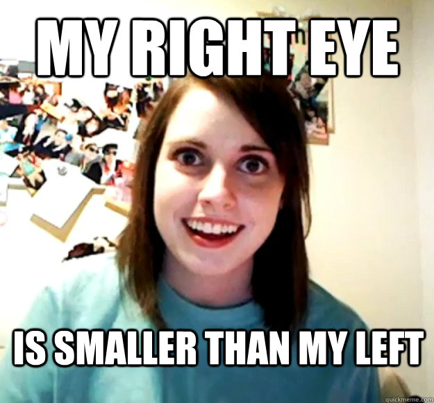 my right eye is smaller than my left - my right eye is smaller than my left  Overly Attached Girlfriend