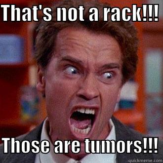 That's a tumor! - THAT'S NOT A RACK!!!    THOSE ARE TUMORS!!! Misc