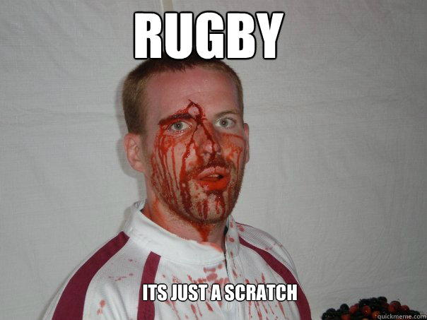 Rugby its just a scratch  Rugby