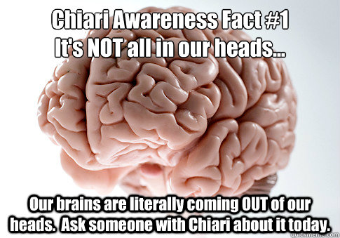 Chiari Awareness Fact #1
It's NOT all in our heads... Our brains are literally coming OUT of our heads.  Ask someone with Chiari about it today.   Scumbag Brain