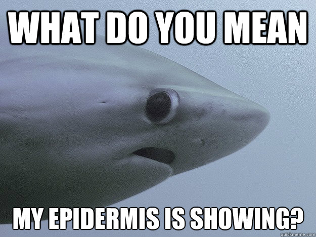 WHAT DO YOU MEAn MY EPIDERMIS IS SHOWING?  Shy Shark