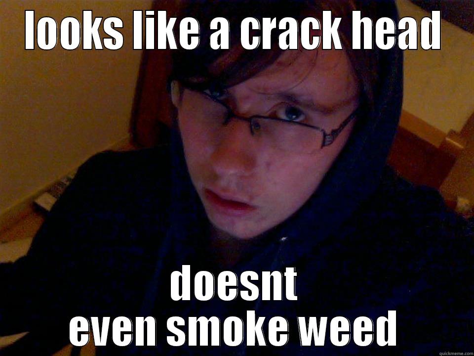 LOOKS LIKE A CRACK HEAD DOESNT EVEN SMOKE WEED Misc