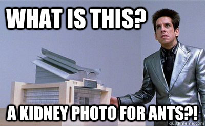 What is this? A KIDNEY PHOTO FOR ANTS?! - What is this? A KIDNEY PHOTO FOR ANTS?!  Zoolander