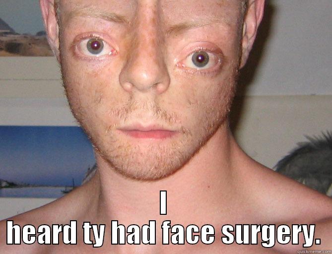  I HEARD TY HAD FACE SURGERY. Misc