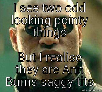 I SEE TWO ODD LOOKING POINTY THINGS BUT I REALISE THEY ARE ANN BURNS SAGGY TITS Matrix Morpheus