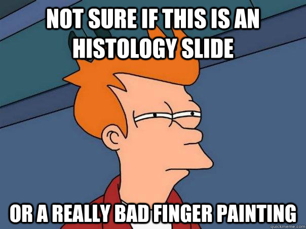 not sure if this is an histology slide or a really bad finger painting  Futurama Fry