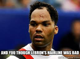 And you though lebron's hairline was bad  