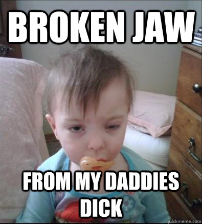 broken jaw from my daddies dick  Party Toddler