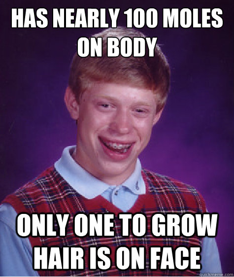 Has nearly 100 moles on body only one to grow hair is on face  Bad Luck Brian