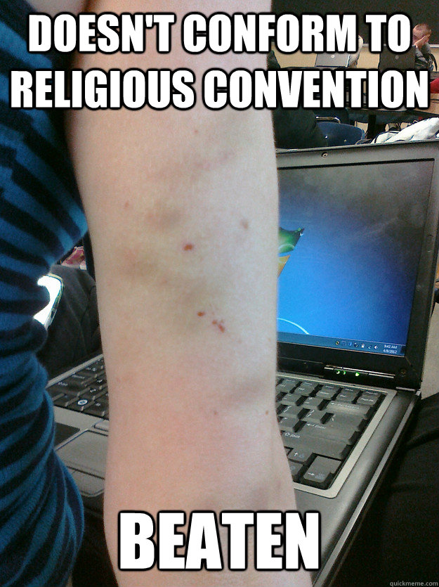 Doesn't conform to religious convention Beaten  Poor arm