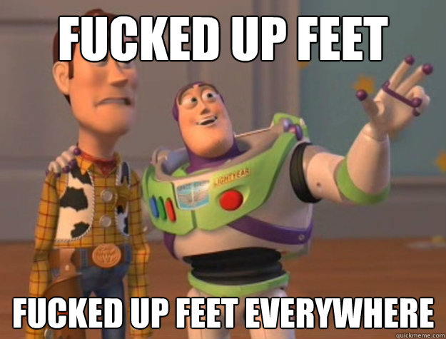 Fucked Up Feet Fucked Up Feet Everywhere  Buzz Lightyear