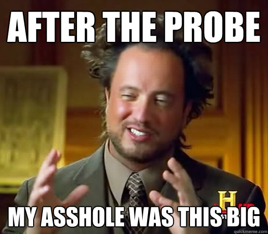 after the probe my asshole was this big - after the probe my asshole was this big  Ancient Aliens