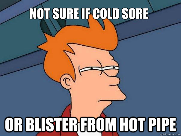 Not sure if cold sore or blister from hot pipe  Futurama Fry