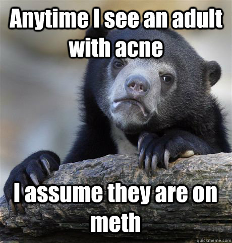 Anytime I see an adult with acne I assume they are on meth  Confession Bear