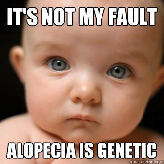 It's not my fault alopecia is genetic  Serious Baby