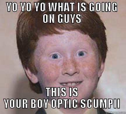 YO YO YO WHAT IS GOING ON GUYS THIS IS YOUR BOY OPTIC SCUMPII Over Confident Ginger