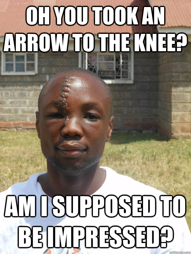 Oh you took an arrow to the knee? Am I supposed to be impressed?  