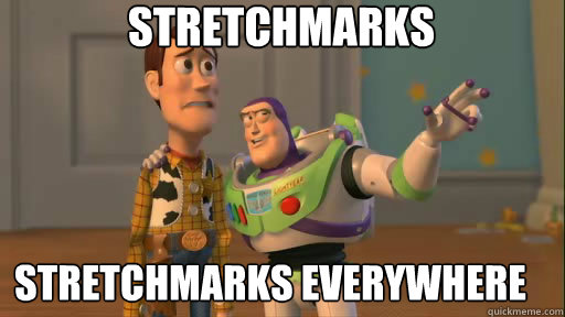 stretchmarks stretchmarks everywhere  - stretchmarks stretchmarks everywhere   Everywhere