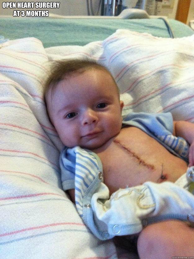 OPEN HEART SURGERY AT 3 MONTHS WHAT HAVE YOU DONE TODAY?  Ridiculously Goodlooking Surgery Baby