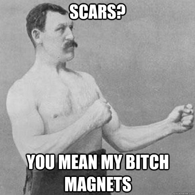 scars? You mean my bitch magnets  overly manly man