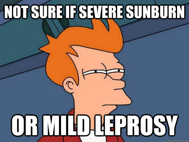 not sure if severe sunburn or mild leprosy  - not sure if severe sunburn or mild leprosy   Futurama Fry
