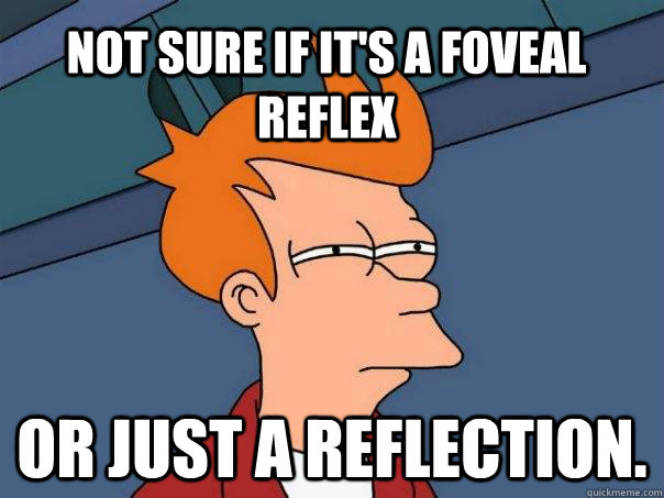 Not sure if it's a foveal reflex or just a reflection. - Not sure if it's a foveal reflex or just a reflection.  Futurama Fry