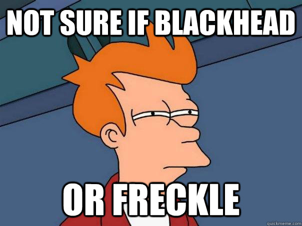 not sure if blackhead or freckle  Futurama Fry