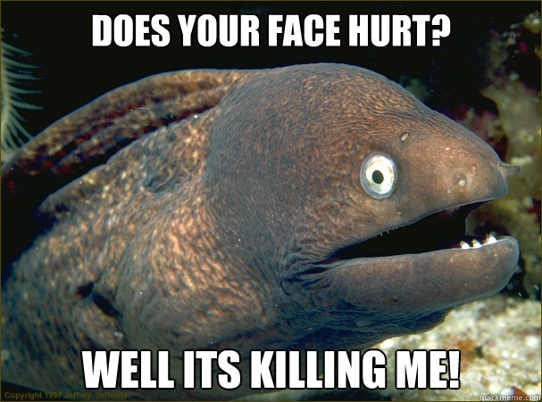 Does your face hurt? Well its killing me!  Bad Joke Eel