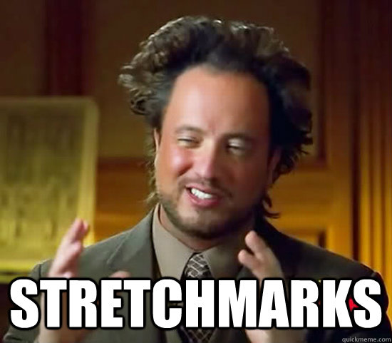 Stretchmarks - Stretchmarks  Ancient Aliens