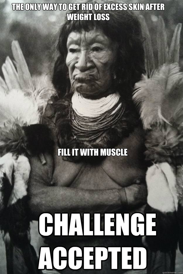 The only way to get rid of excess skin after weight loss CHALLENGE ACCEPTED FILL IT WITH MUSCLE  - The only way to get rid of excess skin after weight loss CHALLENGE ACCEPTED FILL IT WITH MUSCLE   IRL me gusta  challenge accepted