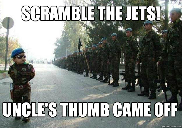 Scramble the jets! Uncle's thumb came off  Army child