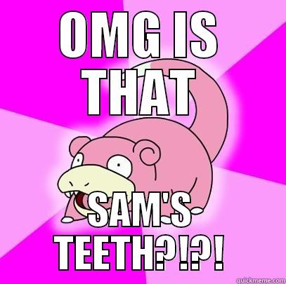 OMG IS THAT SAM'S TEETH?!?! Slowpoke