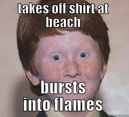 TAKES OFF SHIRT AT BEACH BURSTS INTO FLAMES Over Confident Ginger