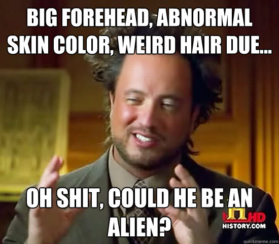 big forehead, abnormal skin color, weird hair due... oh shit, could HE be an alien? - big forehead, abnormal skin color, weird hair due... oh shit, could HE be an alien?  Ancient Aliens