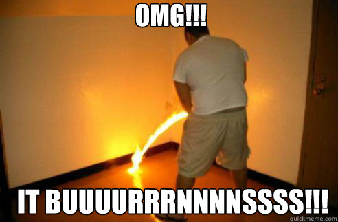 OMG!!!
 IT BUUUURRRNNNNSSSS!!! - OMG!!!
 IT BUUUURRRNNNNSSSS!!!  Flaming Piss