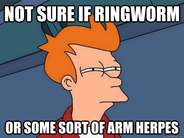 Not sure if ringworm Or some sort of arm herpes  Futurama Fry