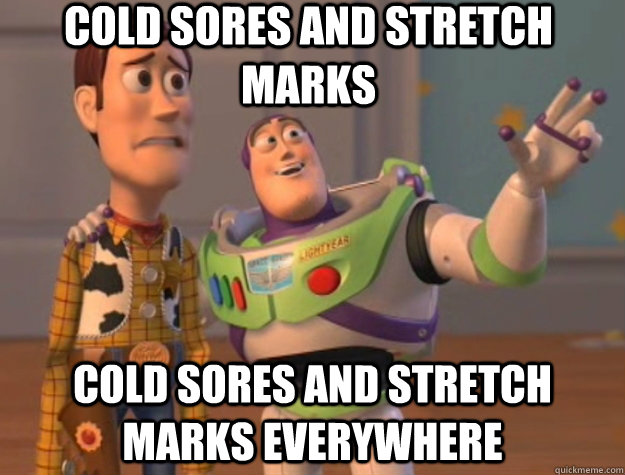 Cold sores and stretch marks Cold sores and stretch marks everywhere  Toy Story