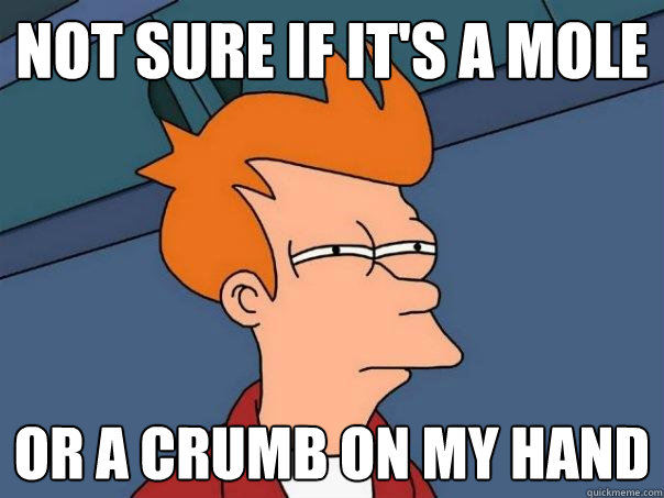 not sure if it's a mole Or a crumb on my hand  Futurama Fry