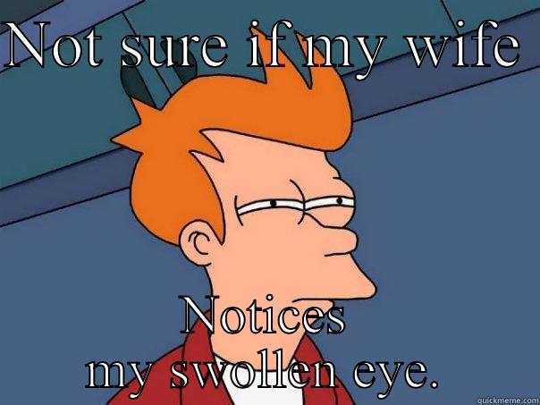 NOT SURE IF MY WIFE  NOTICES MY SWOLLEN EYE. Futurama Fry