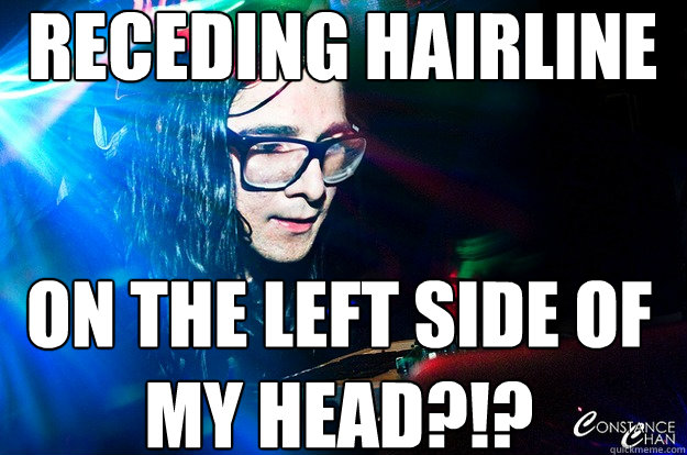   Receding hairline  on the left side of my head?!?  -   Receding hairline  on the left side of my head?!?   Dubstep Oblivious Skrillex