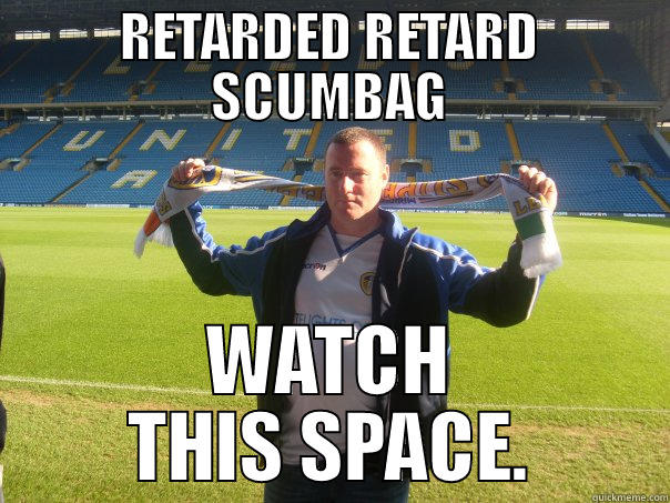 LEEDS..MUST BE STUCK FOR FANS.. - RETARDED RETARD SCUMBAG WATCH THIS SPACE. Misc