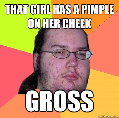 That girl has a pimple on her cheek Gross - That girl has a pimple on her cheek Gross  Butthurt Dweller