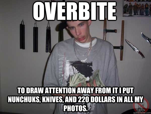 OVERBITE To draw attention away from it I put nunchuks, Knives, and 220 dollars in all my photos.  