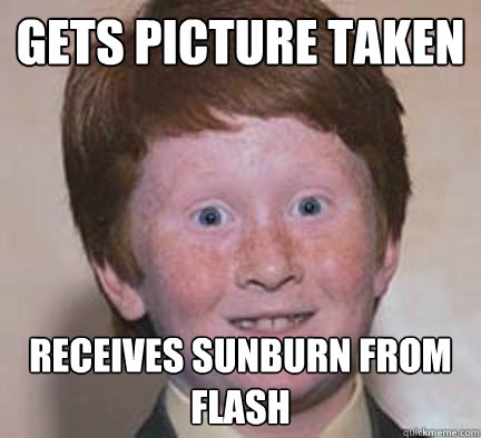 Gets picture taken receives sunburn from flash  Over Confident Ginger