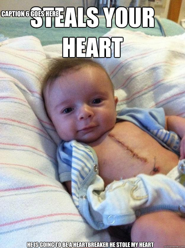 Steals your heart HE IS GOING TO BE A HEARTBREAKER HE STOLE MY HEART Caption 3 goes here Caption 4 goes here Caption 5 goes here Caption 6 goes here  Ridiculously Goodlooking Surgery Baby