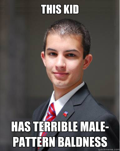 This kid Has terrible male-pattern baldness  College Conservative