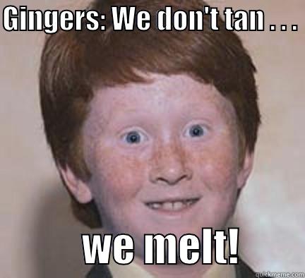 GINGERS: WE DON'T TAN . . .             WE MELT!        Over Confident Ginger