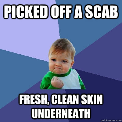 picked off a scab fresh, clean skin underneath  Success Kid