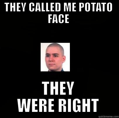 THEY CALLED ME POTATO FACE THEY WERE RIGHT Misc