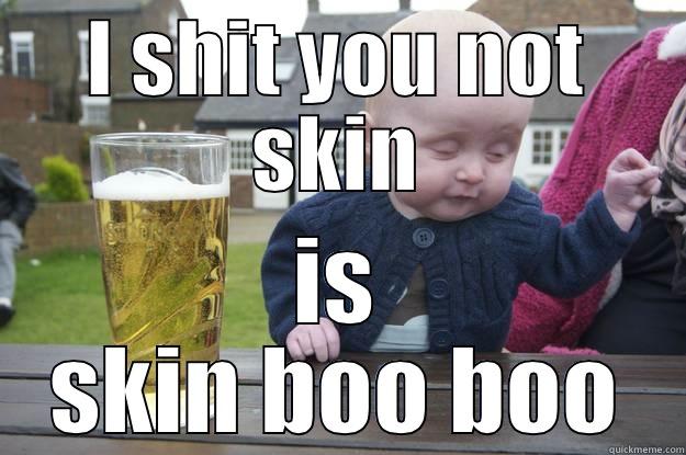 I SHIT YOU NOT SKIN IS SKIN BOO BOO drunk baby